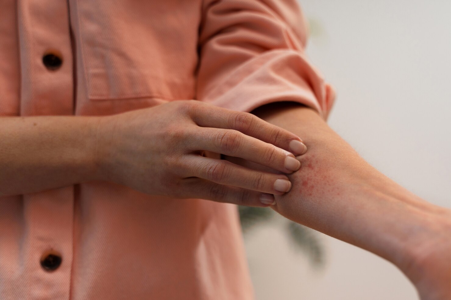person-dealing-with-rosacea_23-2150478696