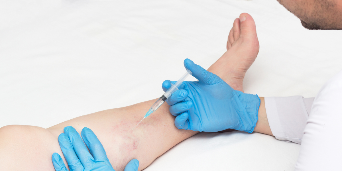 Accessible, Expert Vein Care Close To Home