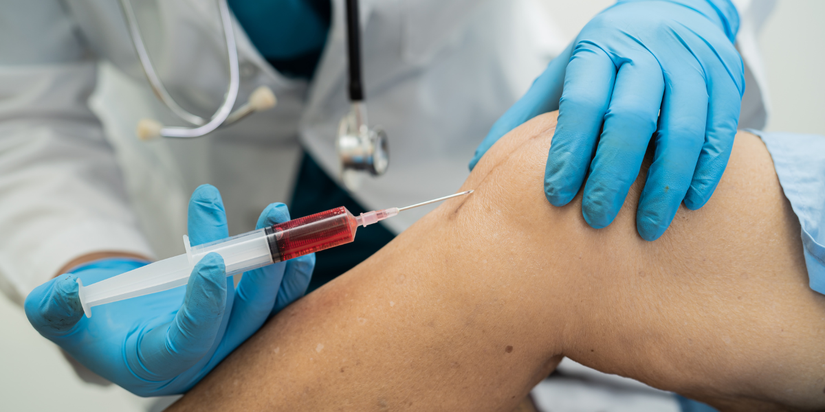 Benefits and Potential Limitations of PRP Injections 