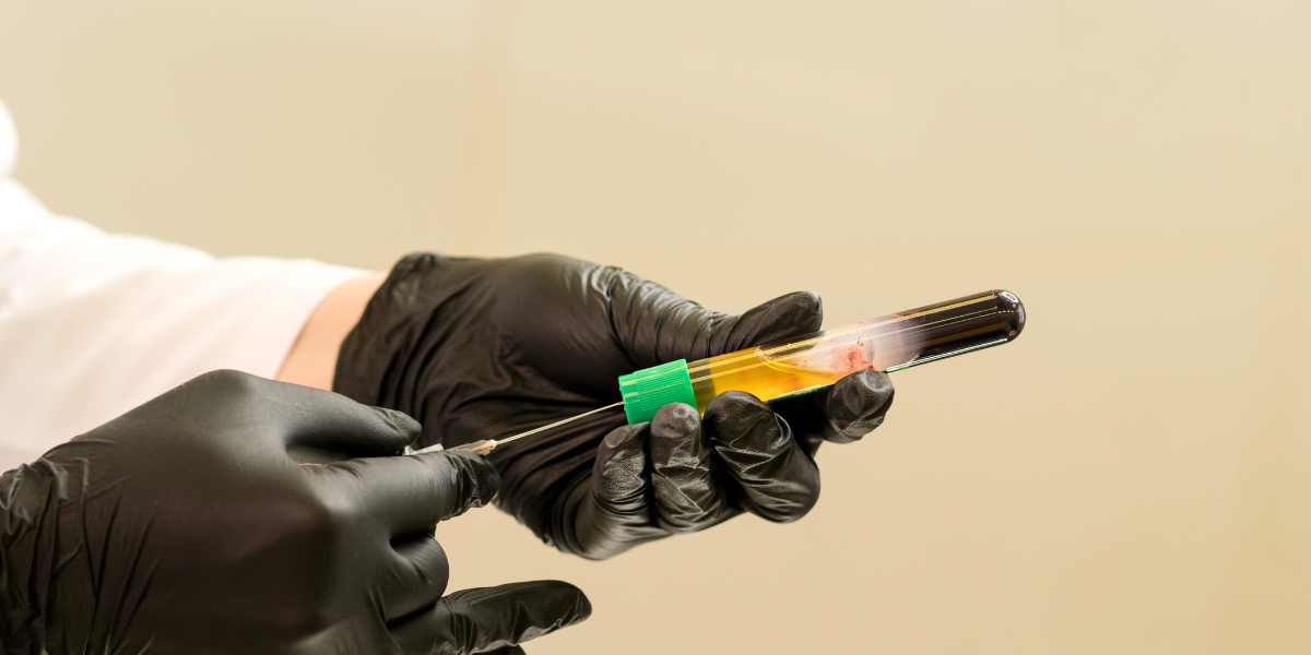 When Should You Consider PRP Injections for Foot Pain