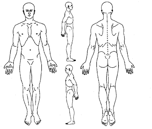 Pain Diagram - Full Body Views