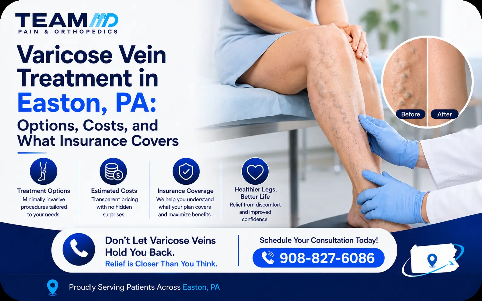 Varicose Vein Treatment in Easton, PA